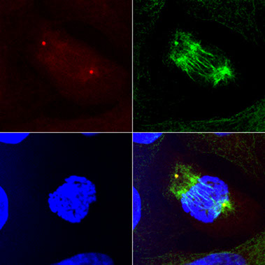 mitotic spindle and chromosomes in ad-tax-transduced hela cells