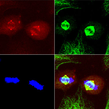 mitotic spindle and chromosomes in ad-tta-transduced hela cells