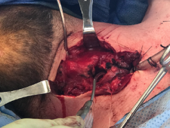 JKSA, CCTS Trauma