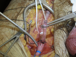 JKSA, Trauma Surgery img