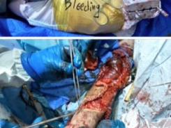 JKSA, Procedural Skills Courses, For Surgical Specialties section 2