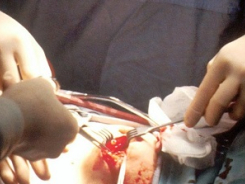 Trauma surgery