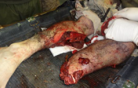 JKSA, Know Ortho Trauma 11 -img