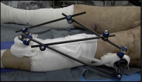 JKSA, Know Ortho Trauma 13 -img