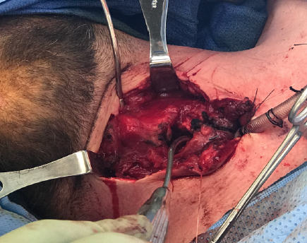 JKSA, CCTS Trauma