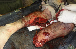 JKSA, Know Ortho Trauma 11 -img