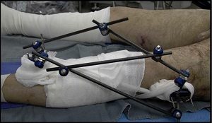 JKSA, Know Ortho Trauma 13 -img