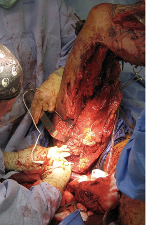 Ortho Trauma 1 -img
