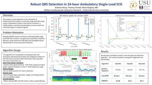 MED - Robust QRS Detection - chart