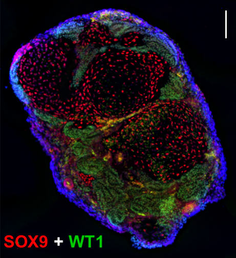 BIO - Jordan lab - organoid
