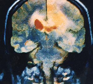 NRM-NEU Xray - decorative