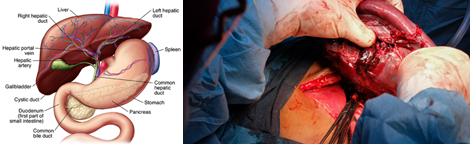 JKSA Advanced General Surgery Procedures - Decorative 